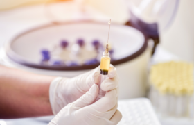 Plasma rico en plaquetas (PRP) y cómo se usa en Ginecología