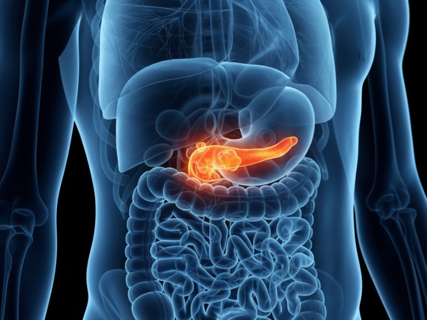 Nuevos desafíos metabólicos: hipertrigliceridemia severa, MASLD y lípidos