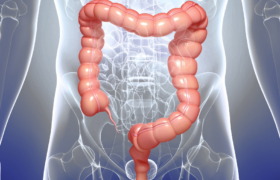 Sangrado al ir al baño