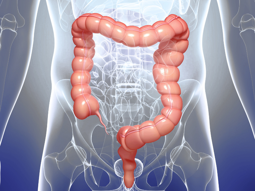 ¿Sangrado al ir al baño, cuando consultar al especialista?